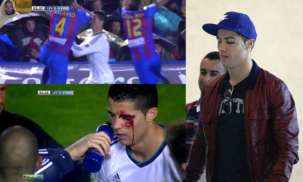 Ronaldo Absen Setelah Penglihatannya Terganggu